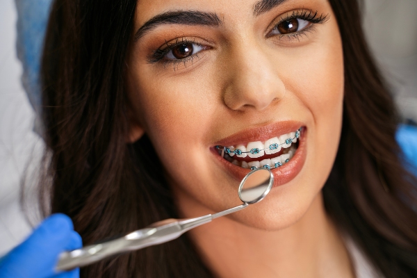Reasons To Consider Braces