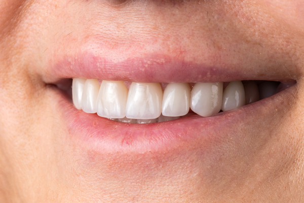 How An Orthodontist Can Help Correct Your Bite And Alignment Issues